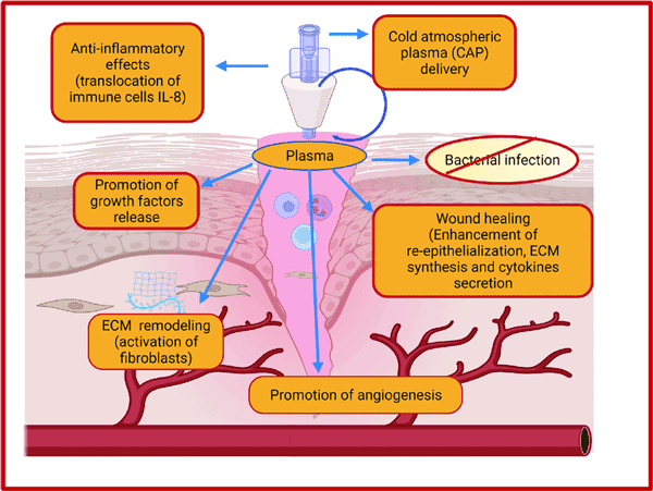 نمودار علل آکنه شامل جوش صورت و تغییرات هورمونی