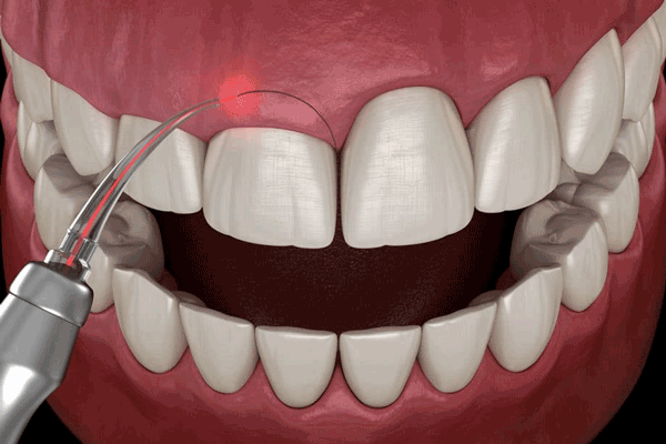 نمودار علل مشکلات دهان و دندان شامل پوسیدگی دندان و بیماری‌های لثه