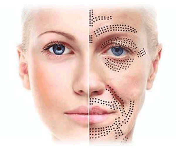 نمودار علل افتادگی پلک شامل پیری پوست و تجمع چربی