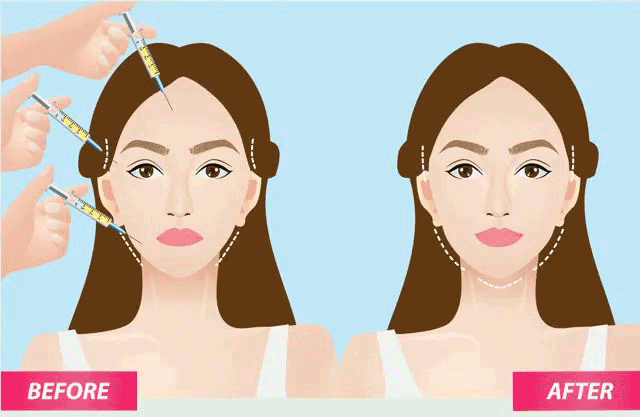 نمودار علل کانتورینگ صورت شامل افتادگی پوست و چین‌وچروک