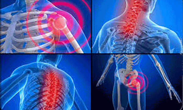 نمودار علل دردهای اسکلتی-عضلانی شامل صدمات و التهاب