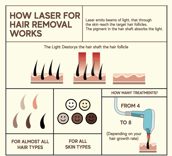 تکنولوژی لیزر در حذف موهای زائد