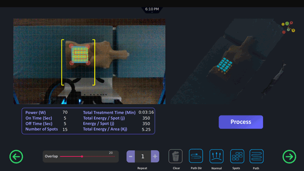 تنظیمات و کنترل هوشمند در درمان‌های رباتیک