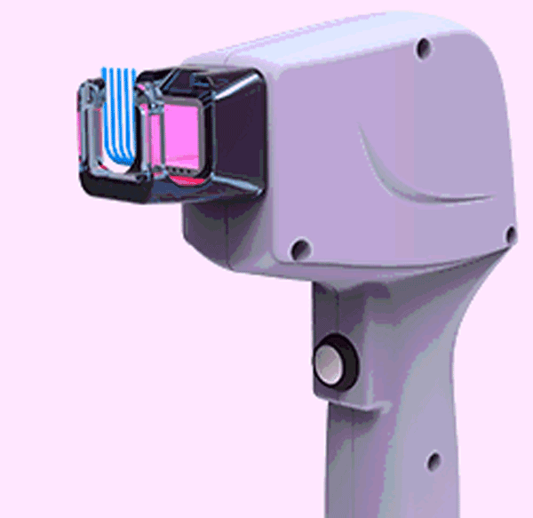 تجربیات بیماران با دستگاه لیزر حذف موهای زائد رکسانا سنس زیرو تاچ